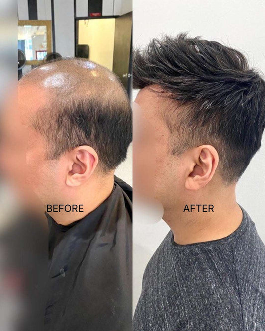 Toupee for Men  to cover hair loss and hair baldness (8X6)