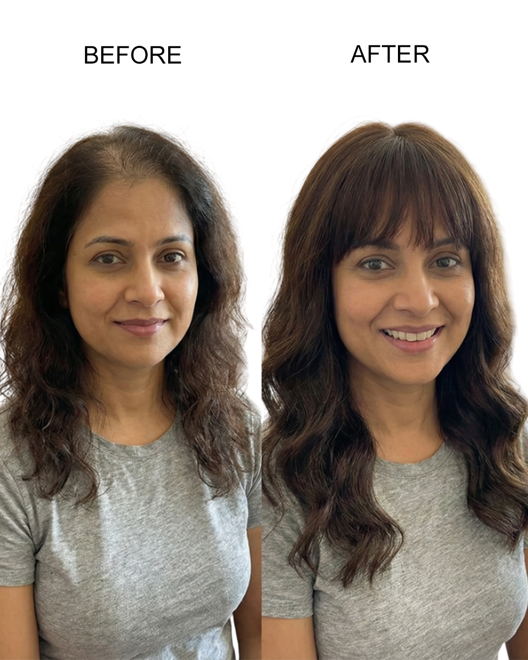 Before / After Image