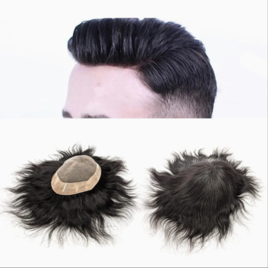 Men Hair Patch to cover hair loss and baldness (8X6)