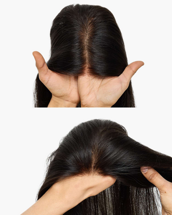 4 x 5 Inch Hair Toppers for Receding Front Hairline for Women